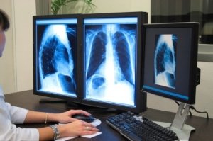 Radiology Scans